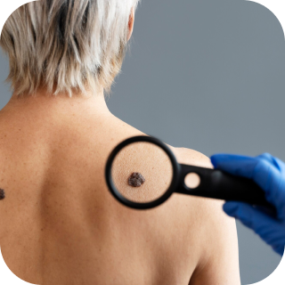 Онкодерматология 